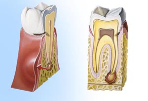 root canal therapy root canal therapy