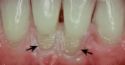 open neck areas