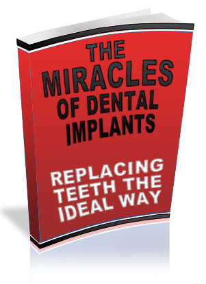 dental implants dental implants