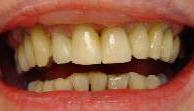 cosmetic dentistry