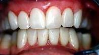 cosmetic dentistry