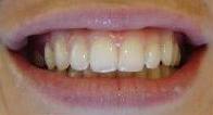 cosmetic dentistry