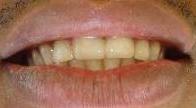 cosmetic dentistry