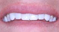 cosmetic dentistry