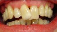 cosmetic dentistry