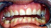 cosmetic dentistry