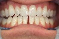 cosmetic dentistry